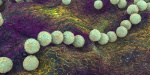 A rare flesheating bacteria with a terrifying mortality rate that can kill people in 48 hours is spreading in Japan  Fortune A rare flesheating bacteria with a terrifying mortality rate that can kill people in 48 hours is spreading in Japan  Fortune