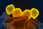 A rare deadly bacterial infection is on the rise in Japan What is STSS  The Washington Post