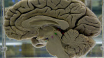 Scans show reorganization of brain during pregnancy  The Hill Scans show reorganization of brain during pregnancy  The Hill