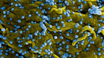 Rwanda is dealing with its first outbreak of deadly Marburg virus disease CNN Rwanda is dealing with its first outbreak of deadly Marburg virus disease CNN