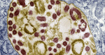 Marburg virus kills 10 in Rwanda What to know about the Ebolalike outbreak and symptoms  CBS News Marburg virus kills 10 in Rwanda What to know about the Ebolalike outbreak and symptoms  CBS News
