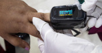FDAs promised rules on pulse oximeters unlikely to end decades of racial bias  CBS News FDAs promised rules on pulse oximeters unlikely to end decades of racial bias  CBS News