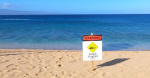 Maui surfer loses part of leg in shark attack officials say  CBS News Maui surfer loses part of leg in shark attack officials say  CBS News