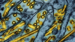 Canadian teen in critical condition with bird flu source of exposure is unknown CNN Canadian teen in critical condition with bird flu source of exposure is unknown CNN