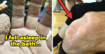 48 Absolutely Fascinating Photos Of Injuries Conditions And Disorders That Prove Humans Are Freaking Metal  BuzzFeed