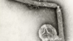 Bird flu virus likely mutated within a Louisiana patient CDC says The Associated Press Bird flu virus likely mutated within a Louisiana patient CDC says The Associated Press