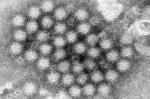 Norovirus cases are surging in parts of the US CDC data shows AOL Norovirus cases are surging in parts of the US CDC data shows AOL