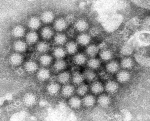 Norovirus is back in full force with US cases of stomach virus surging  syracusecom