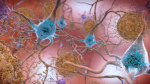 Antiamyloid therapy may keep Alzheimers symptoms at bay in certain patients study suggests  CNN