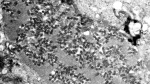 Organ transplant patient in Michigan dies from rabies The Associated Press Organ transplant patient in Michigan dies from rabies The Associated Press