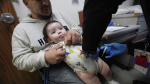 Measles exploded in Texas after stagnant vaccine funding New cuts threaten the same across the US AP News Measles exploded in Texas after stagnant vaccine funding New cuts threaten the same across the US AP News