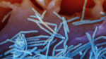 Experts recommendations on RSV and meningitis vaccines will go to exprosecutor now at CDC AP News Experts recommendations on RSV and meningitis vaccines will go to exprosecutor now at CDC AP News