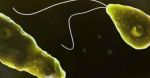 Texas woman dies from braineating amoeba after clearing sinuses with tap water Dallas News Texas woman dies from braineating amoeba after clearing sinuses with tap water Dallas News