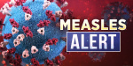 Measles case confirmed in Johnson Co  KCRG