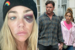 Denise Richards alleges estranged husband Aaron Phypers threatened to kill her gets restraining order  Page Six Denise Richards alleges estranged husband Aaron Phypers threatened to kill her gets restraining order  Page Six