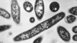 4th person dies after a Legionnaires disease outbreak sickens dozens in New York City AP News 4th person dies after a Legionnaires disease outbreak sickens dozens in New York City AP News