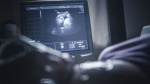 Another major medical association breaks from CDC as obgyn group recommends Covid19 vaccines during pregnancy  CNN Another major medical association breaks from CDC as obgyn group recommends Covid19 vaccines during pregnancy  CNN
