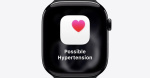 Apple Watch hypertension alerts feature receives FDA clearance  9to5Mac