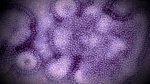 Sixth child in Mass dies of flu  WCVB