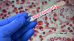Hantavirus cases spark surge in pharma and biotech stocks  heres why  CNBC
