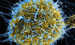 Ebola disease outbreak in the Democratic Republic of the Congo and Uganda  ECDC
