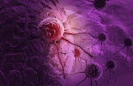 Landmark pancreatic cancer drug keeps patients alive for twice as long  The Washington Post