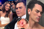 Tom Sandovals girlfriend Victoria Robinson arrested for alleged attack that left Bravo star bloody bruised  Page Six