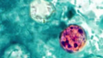 Michigan Cyclosporiasis outbreak tops 700 cases as health officials search for source  ClickOnDetroit  WDIV Local 4