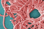 New York City health officials search for source of Upper East Side Legionnaires outbreak linked to 36 cases  ABC7 New York