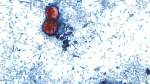 Norton warns parasitic infection causing explosive diarrhea is on the rise in Kentucky  WLKY