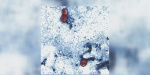 Parasitic stomach illness that can cause explosive diarrhea rises in Louisiana  fox8livecom
