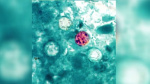 Precautions to take as cyclosporiasis cases in Michigan exceed 1500  ClickOnDetroit  WDIV Local 4