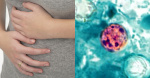 Parasite causing major stomach symptoms  KTVU