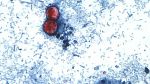 Cyclospora in Maryland Cases more than double since last week  WBALTV