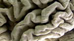 Study shows a blood test can help identify healthy people at high risk for Alzheimers disease  ABC News  Breaking News Latest News and Videos