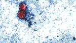 CDC Disease detectives to investigate cyclosporiasis cases in Ohio  FOX 8 News