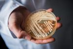 Superbug confirmed in 23 states Where is the deadly fungus spreading in 2026  The Hill