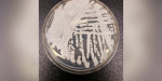Arizona sees surge in Superbug fungus cases CDC data shows  AZ Family