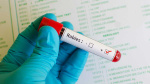 Davidson County warns of rabies exposure after four goats test positive at Lexington petting zoo  WXII