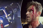 Pretty Little Liars star Keegan Allen robbed at gunpoint knifepoint in attack outside luxury Hollywood grocery store  Page Six