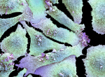 Beyond cigarettes Uncovering the causes of lung cancer in nonsmokers  The Washington Post