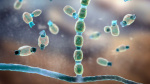 After cases from music festival Valley fever risk continues through the fall California health officials warn  CNN After cases from music festival Valley fever risk continues through the fall California health officials warn  CNN