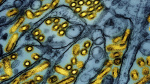 California declared an emergency over bird flu How serious is the situation The Associated Press California declared an emergency over bird flu How serious is the situation The Associated Press
