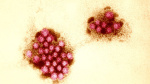 Norovirus outbreaks surge across US What you need to know  FOX 9 MinneapolisSt Paul
