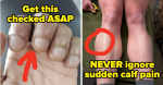 Doctors And Nurses Are Revealing The Small Health Signs You Should Never Ignore And Its Shocking  BuzzFeed Doctors And Nurses Are Revealing The Small Health Signs You Should Never Ignore And Its Shocking  BuzzFeed