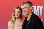 LeAnn Rimes Talks Dental Issues That Led to Losing Her Teeth Onstage  The Anger Around Her Eddie Cibrian Affair  Billboard