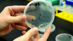 Flesh eating bacteria kills 1 person in South Florida in 2025  WPLG Local 10 Flesh eating bacteria kills 1 person in South Florida in 2025  WPLG Local 10