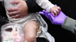 Worried about splitting up the MMR vaccine into three separate shots You should be this doctor says  CNN Worried about splitting up the MMR vaccine into three separate shots You should be this doctor says  CNN