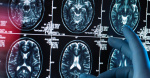 Researchers Have Discovered 2 New Dementia Risk Factors Heres What They Are  HuffPost