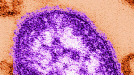 As a measles outbreak burns through South Carolina not enough people are getting vaccinated  CNN
